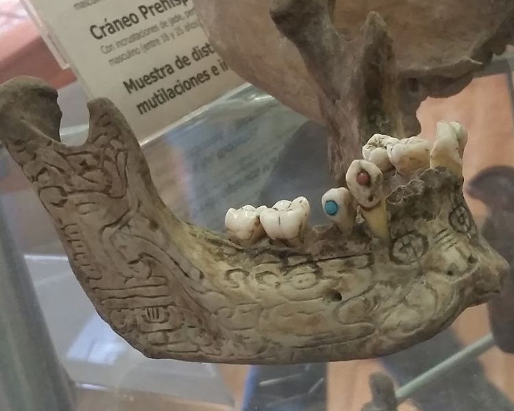 Sala de la Odontología Mexicana Dr. Samuel Fastlicht, un recorrido por la evolución dental en México