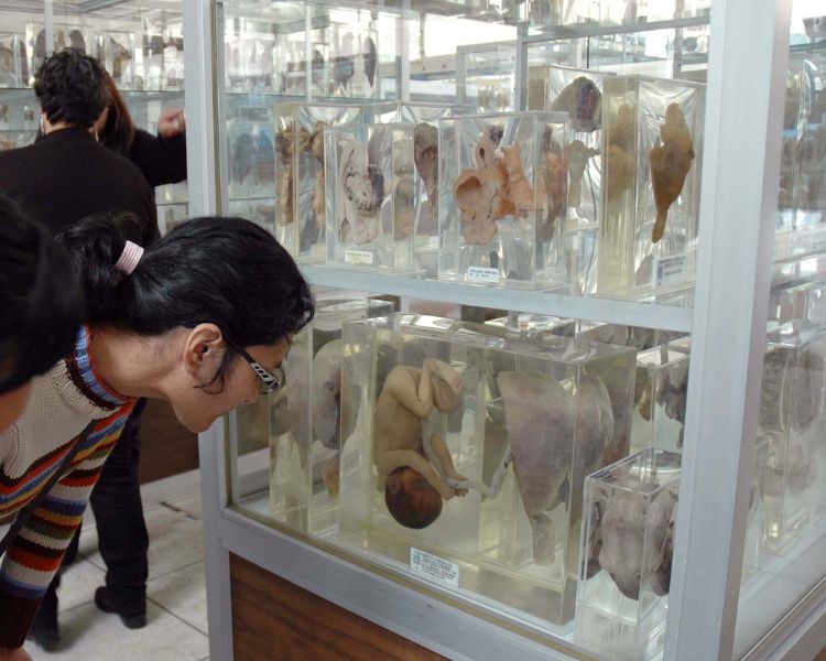 Museo de Patología Eduardo Liceaga, un viaje por el cuerpo en el Hospital General de México