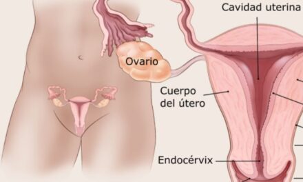 Nuevas esperanzas en el tratamiento del cáncer de endometrio: avances en inmunoterapia llegan a México